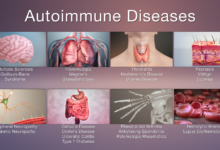Autoimmune Conditions